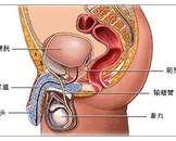 慢性前列腺炎