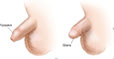 欽州桂大醫(yī)院治療包皮過(guò)長(zhǎng)怎么樣