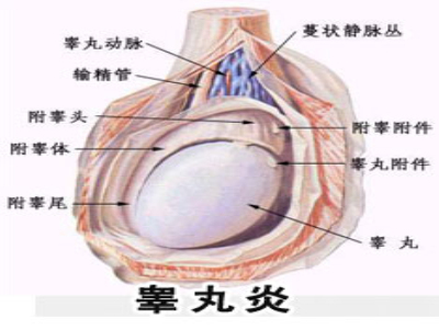 導(dǎo)致睪丸炎的原因有哪些